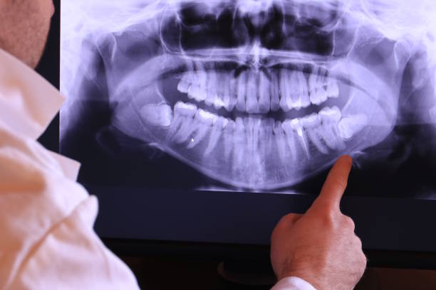 Best Chipped Tooth Repair Near Me  in Jeffersonville, OH