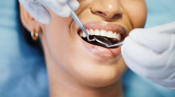 Best Root Canal Emergency Dentist  in Jeffersonville, OH